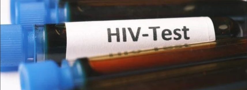 HIV Cure test