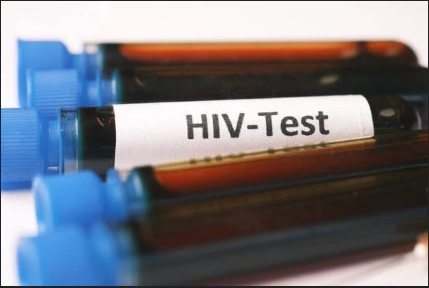 HIV Cure test