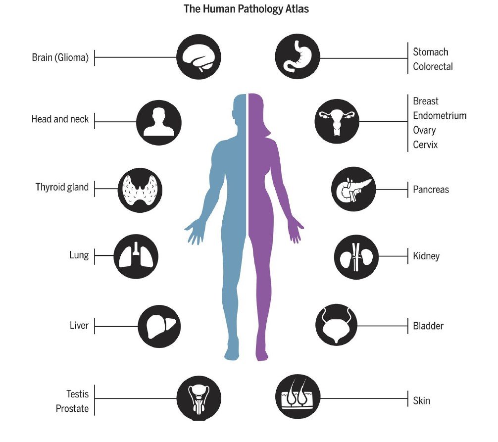 Cancer Reduction with Prakasine Immunotherapy